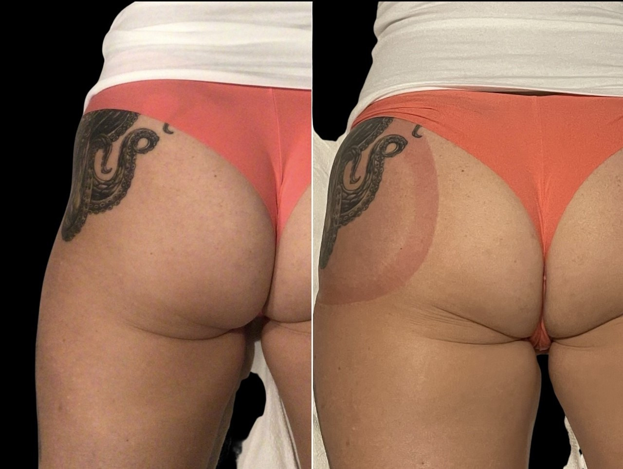 butt2