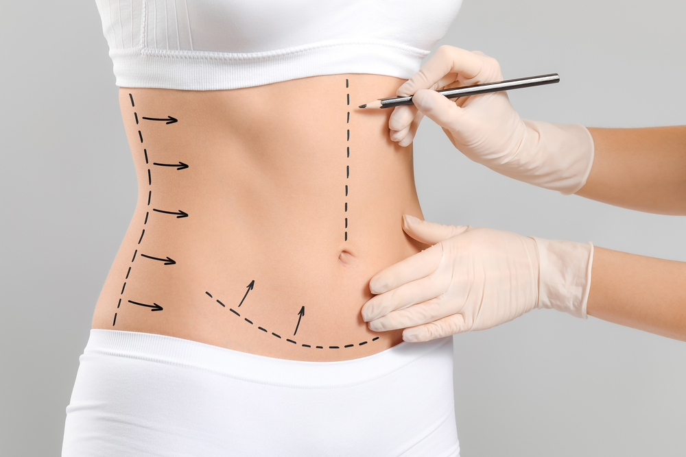Body Contouring Solutions in Commack, NY